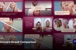 Free Download:Intro - Skincare Result Comparison Premiere Pro Templates 59410241