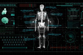 HUD700 Screen MEDICAL2 46283932