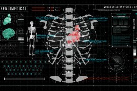 HUD700 Screen MEDICAL3 46324500